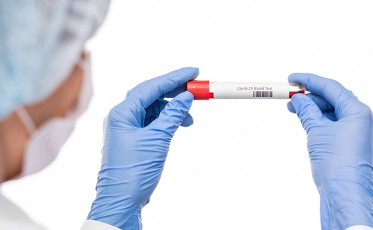 Estado soma mais 1,3 mil casos de Covid-19