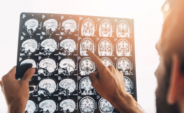 Jornada acadêmica reforça a importância da doação de órgãos