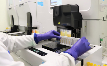 Unimed Criciúma passa a contar com sistema automatizado de última geração para exames de urina