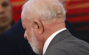 Médico de Lula descarta sequela e diz que função cerebral está intacta