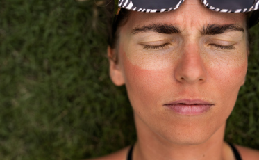 Saiba como cuidar da sua pele no verão