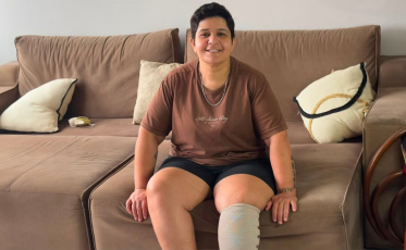 Torção no pé termina em amputação e moradora de Criciúma abre vaquinha para custear prótese