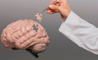 Alzheimer: brasileiros criam ferramenta que ajuda no tratatamento