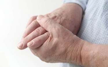 Os cuidados para evitar a artrose nas mãos