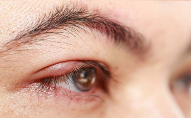 Câncer de pele também pode atingir as pálpebras
