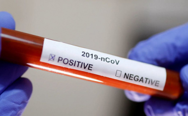 Amurel: Imaruí registra primeira morte por Covid-19 