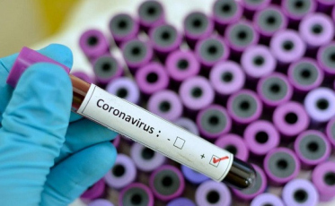 Casos de coronavírus no Brasil chegam a 3,9 mil