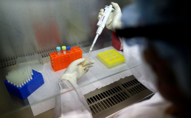 Anvisa permite teste clínico para tratar pneumonia causada por covid