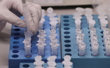 Covid-19: testes de baixo custo são desenvolvidos