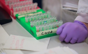 Por que o teste do coronavírus pode dar negativo nas pessoas infectadas?