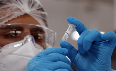 Covid-19: Brasil registra 863 óbitos nas últimas 24 horas