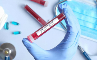 Mais um caso de Covid-19 em Criciúma. Agora são 28