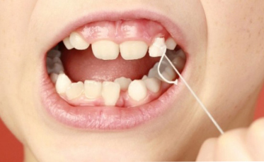 Entenda porque alguns dentes tem tamanhos desproporcionais