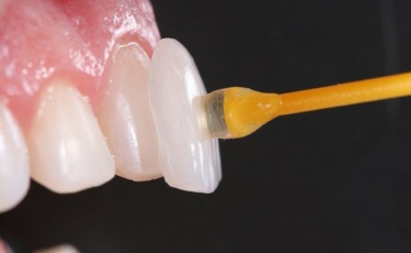 Pós Unesc realiza palestra online gratuita para cirurgiões dentistas
