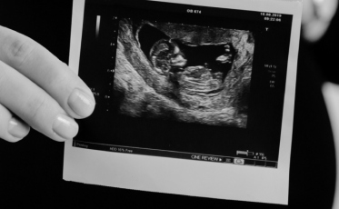 “A partir do momento que gera uma vida, gera responsabilidade sobre ela”, diz conselheiro católico sobre o aborto