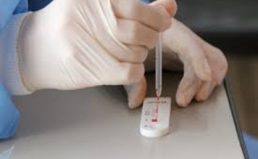 Estado soma mais 1,4 mil casos de Covid-19