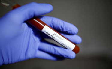 Covid-19: Brasil passa de 20 mil infectados