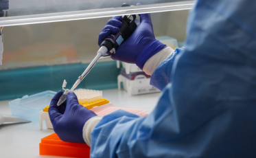 É provável que o número de pacientes contaminados em Criciúma seja maior