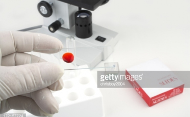 Testes rápidos de hepatite são disponibilizados gratuitamente em Criciúma