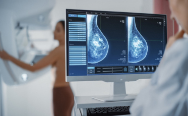 Câncer de mama cresce entre mulheres a partir dos 35 anos