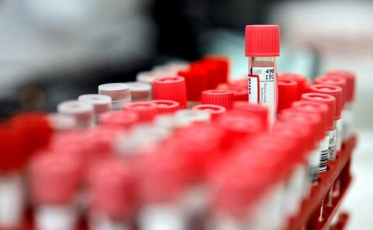 Nova Veneza e Cocal do Sul com novos casos de coronavírus