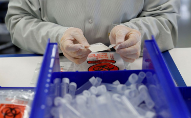 Mais de 16 milhões de casos de Covid-19 já foram registrados no mundo 