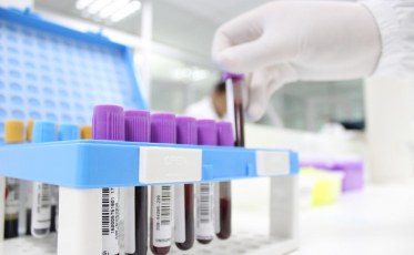 Prefeitura realiza ação de coleta de sangue para detecção de Covid-19