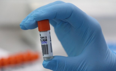 Lacen realiza mais de 405 mil testes RT-PCR em 2020