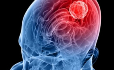 Vigilância Epidemiológica de Içara esclarece suspeita de meningite