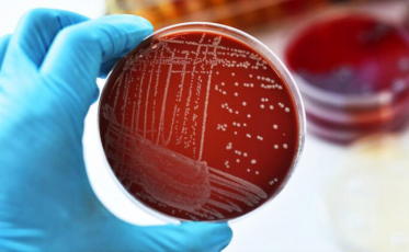 De momento, nenhuma suspeita de meningite em Criciúma