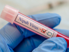 Vírus Nipah: doença já matou mais de 200 pessoas na Ásia; entenda