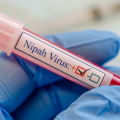 Vírus Nipah: doença já matou mais de 200 pessoas na Ásia; entenda