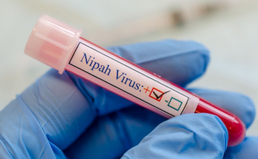 Vírus Nipah: doença já matou mais de 200 pessoas na Ásia; entenda