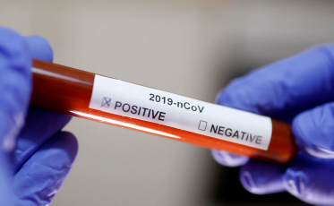 CGJ disponibiliza orientações institucionais sobre a pandemia