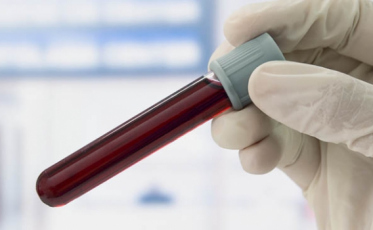 Você sabe o que é o exame de PSA?