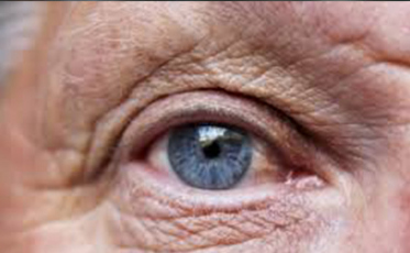 SUS oferece novo tratamento para pacientes com degeneração da retina