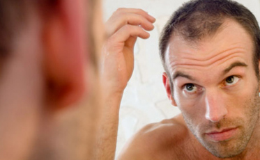 Queda de cabelo: Mitos e verdades