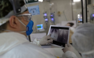 Associações médicas lançam protocolo para triagem de pacientes de UTI